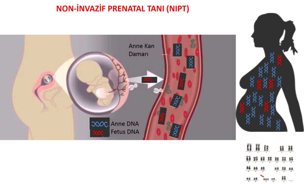 Non Invaziv Prenatal Test