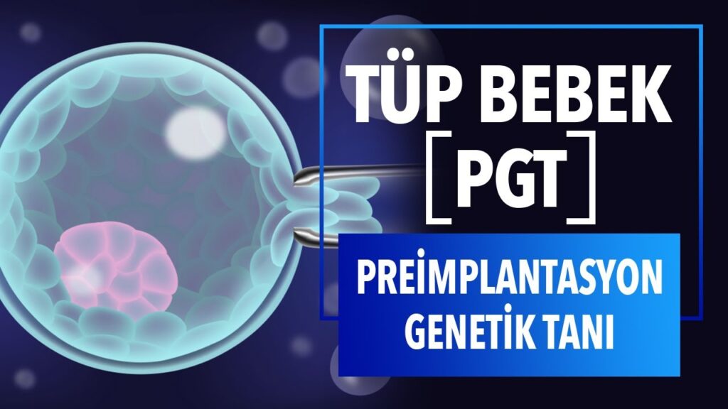 Tup Bebek Tedavisinde PGT 1