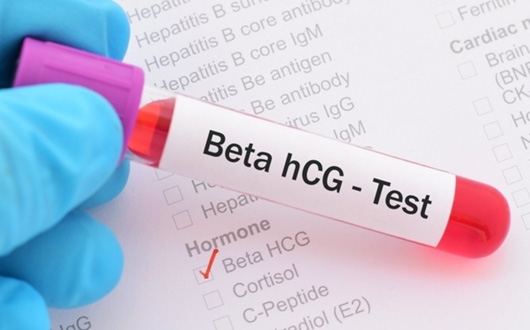 HCG Testi Nedir